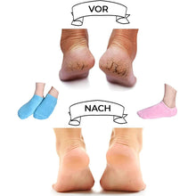 Laden Sie das Bild in den Galerie-Viewer, Feuchtigkeitsspendende Socken mit Gelfutter für die Fußpflege